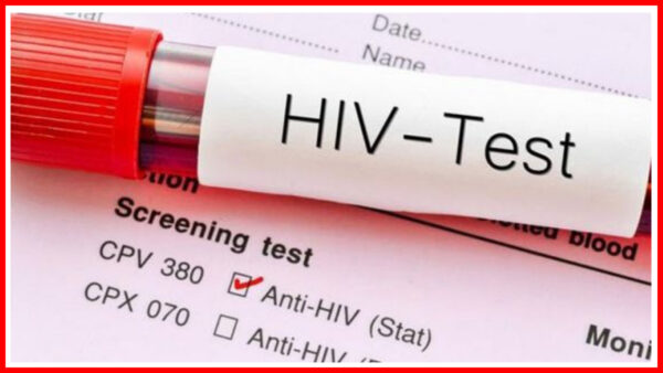 HIV positive (indicative) - Photo: Social Media