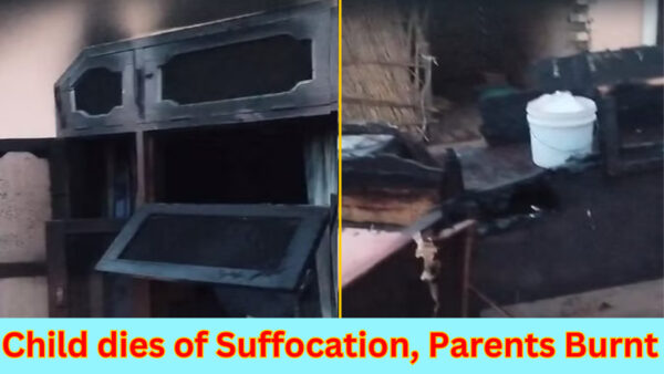 Child dies of suffocation, parents burnt - Photo: Diary Times